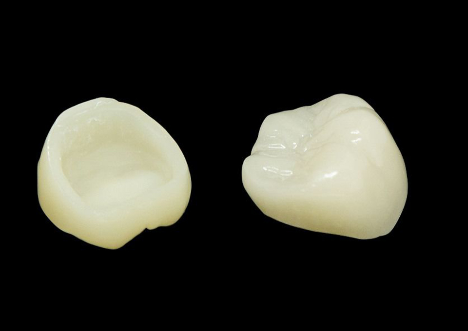 オールセラミック