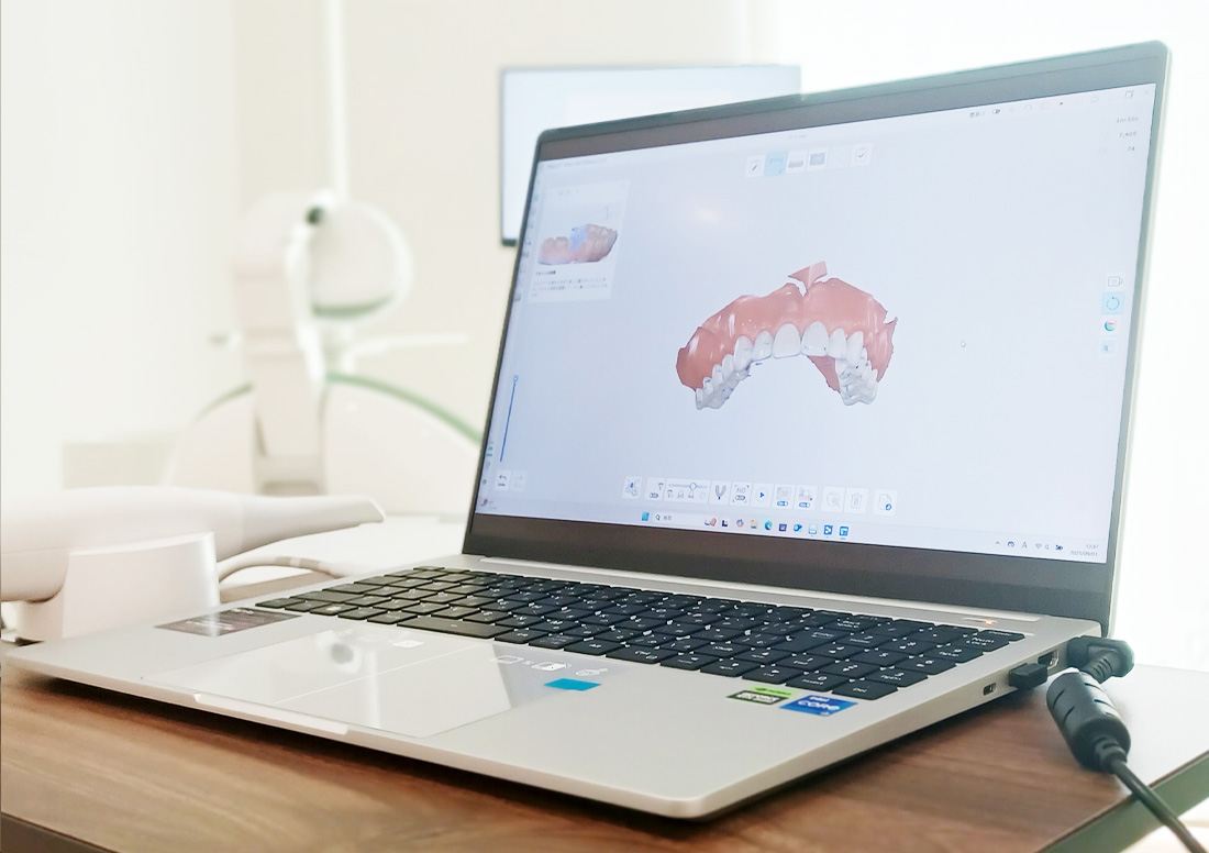 口腔内スキャナー