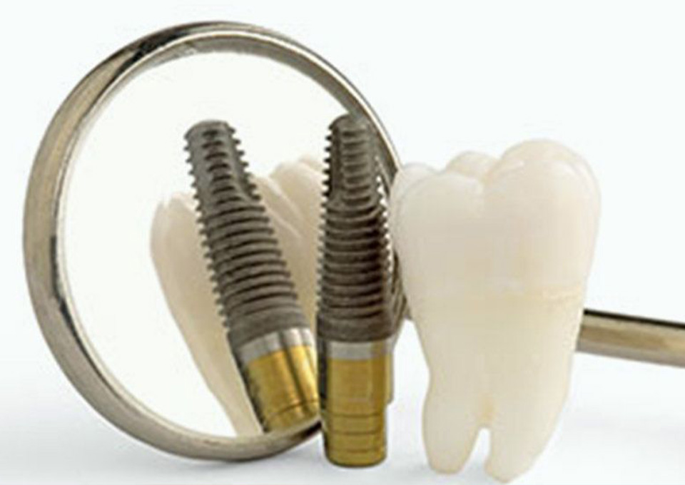 メンテナンスの重要性