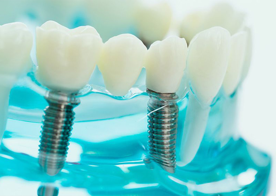 適応できる症例に限りがあります