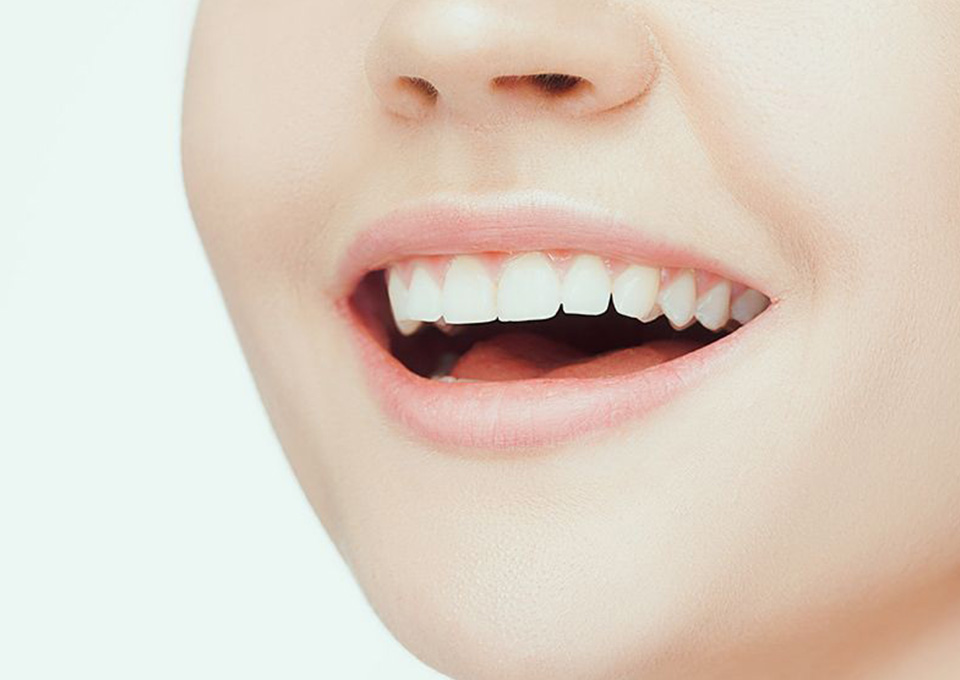 見た目のメリット