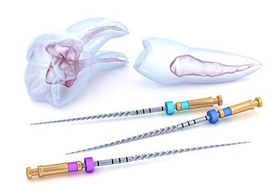 感染した神経を除去する